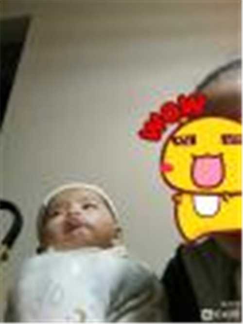 杭州代生供卵医院 杭州做试管婴儿要花多少钱? ‘22周大排畸男宝特征’